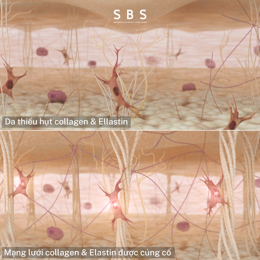hiệu quả bio regen