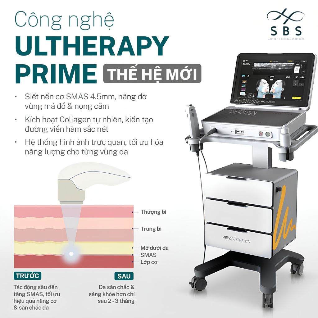 Công nghệ Ultherapy Prime nâng cơ hiện đại